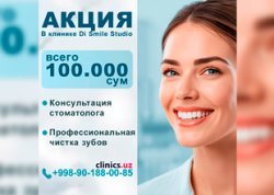 АКЦИЯ — здоровая улыбка всего за 100 000 сум в клинике Di Smile Studio
